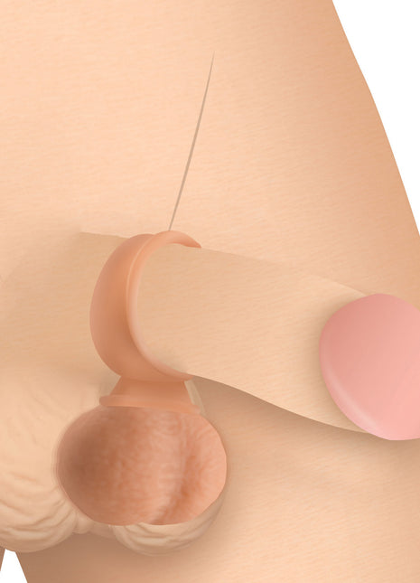 28x Vibrating Realistic Balls With Remote - 35mm